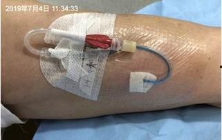 picc封管方法视频,PICC封管操作步骤详解视频教程